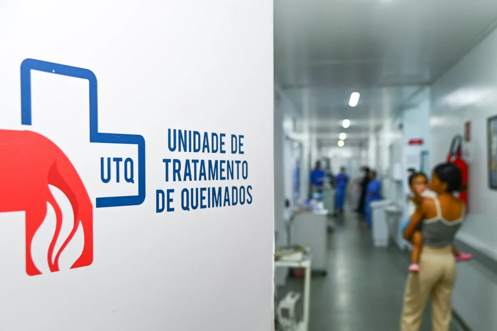 Período junino exige cuidado redobrado com relação aos riscos de queimaduras