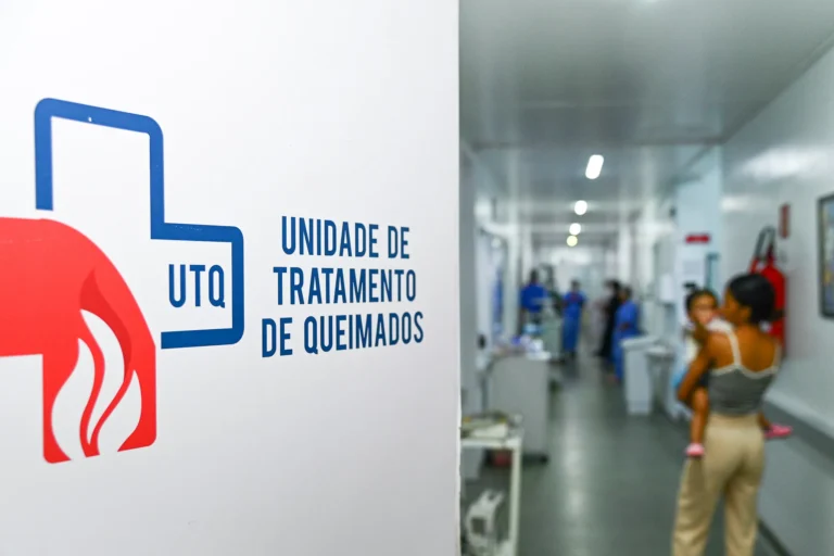 Período junino exige cuidado redobrado com relação aos riscos de queimaduras
