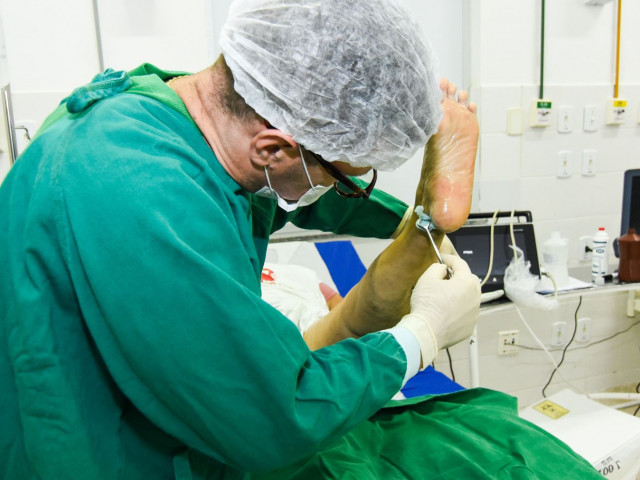 Mutirão realiza 42 cirurgias de varizes no Hospital Nosso Senhor dos Passos