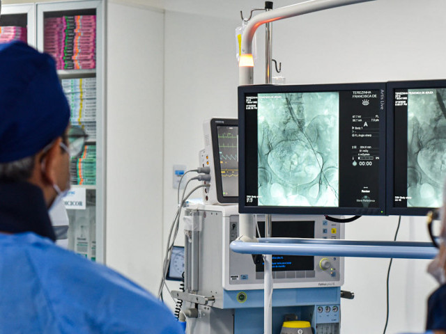 Huse realiza procedimento endovascular inédito para tratar trombose venosa profunda em Sergipe