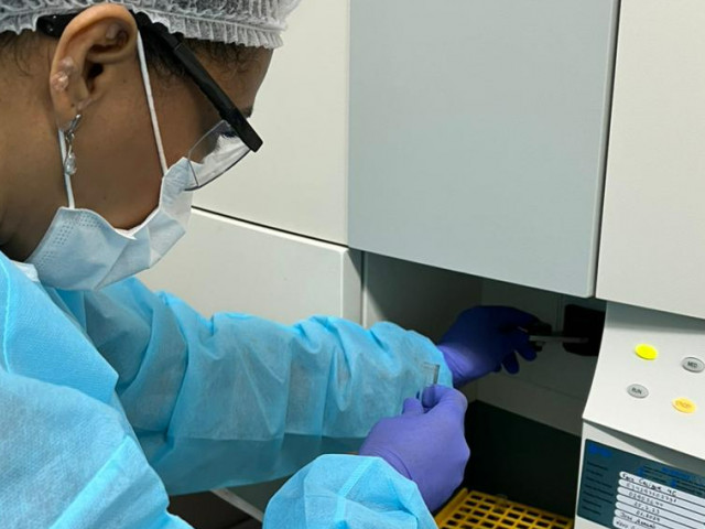 Lacen Sergipe alcança nota máxima em teste de proficiência para monitoramento de HIV