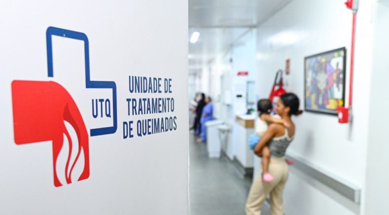 Queimaduras no São João: HUSE orienta como curtir com segurança